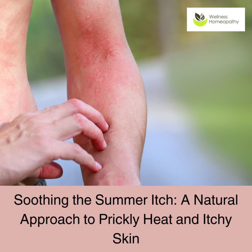 Summer Skin Bliss: A guide to natural relief for prickly heat and itchy skin. Enjoy the sun without the discomfort. Wellness Homeopathy – Your holistic partner for radiant skin. Book a consultation today!