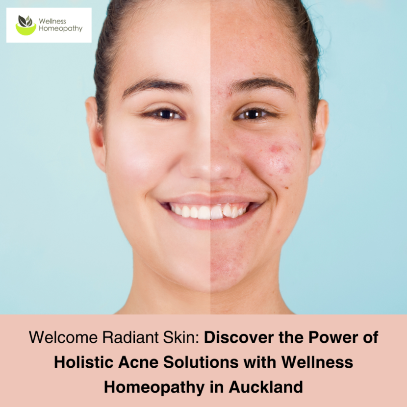 "Discover Wellness Homeopathy's holistic approach to acne in Auckland. Uncover the power of personalized homeopathic remedies and naturopathic lifestyle guidance for radiant, blemish-free skin. Break free from hormonal fluctuations, genetic predispositions, and dietary influences with our expert solutions. Learn how our approach nurtures your skin's vitality, allowing it to breathe freely and heal from within. Book your personalized consultation at our Auckland City, Parnell, or West Auckland (Titirangi) locations for a transformative wellness journey. Elevate your well-being today: call us on 0221899164