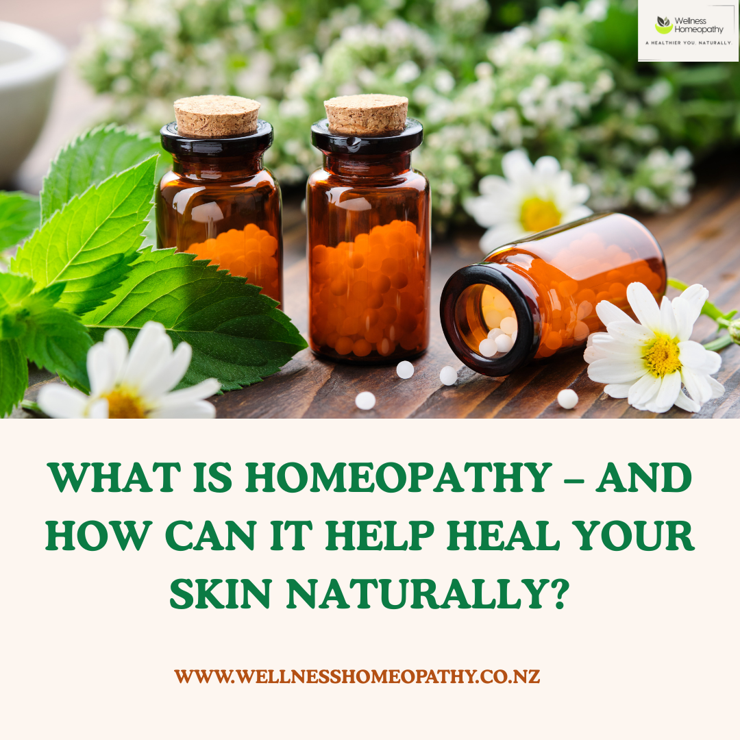 What Is Homeopathy – And How Can It Help Heal Your Skin Naturally?